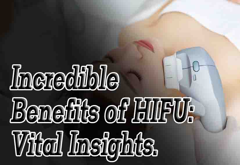 HIFU: Vital Insights